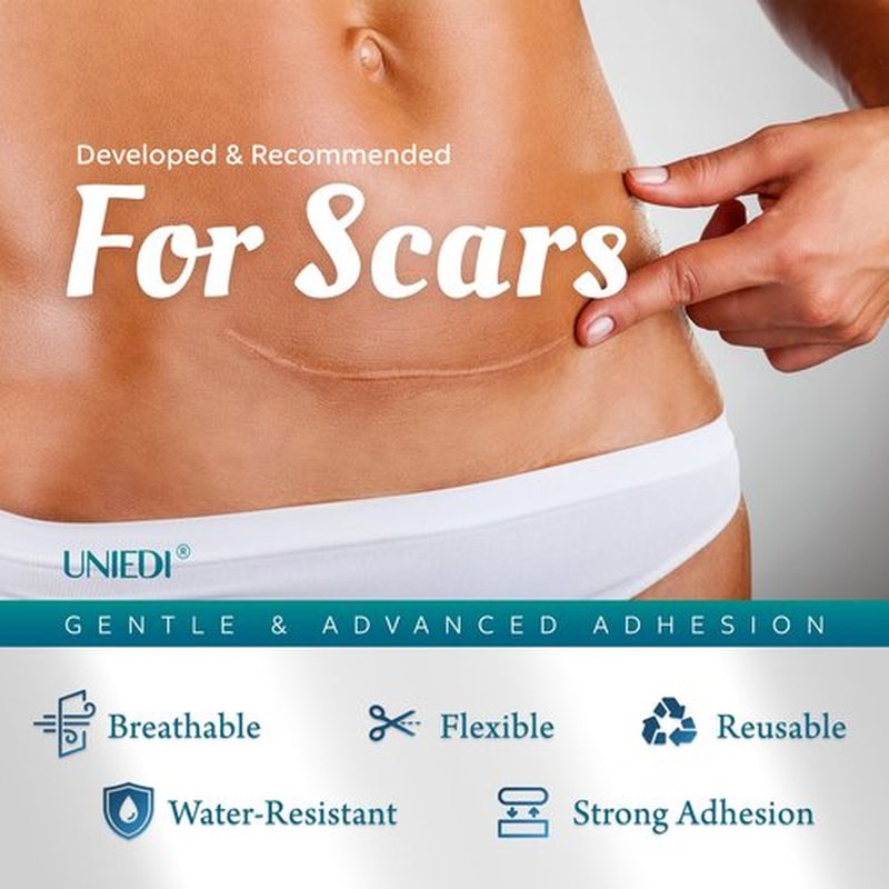 Silicone Scar Sheets, Silicone Scar Tape(1.6"x 120" Roll-300CM), Silicone Tape for Scars, Scar Tape for Surgical Scars, Silicone Scar Strips for C-Section, Tummy Tuck, Keloid, and Surgical Scars