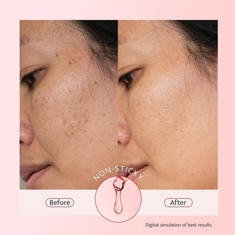 Bestkiss 10% Niacinamide + 5% Tranexamic Acid + 2% Alpha-Arbutin Dark Spot Serum with Ceramides Hyaluronic Acid Centella Asiatica - Korean Glass Skin Vegan Paraben Fragrance Cruelty Free 1 FL OZ/30mL