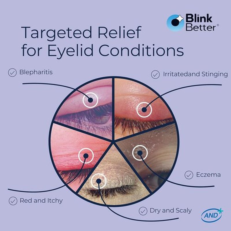 BlinkBetter BetterLids Eyelid Ointment - Deep Moisturizing Formula with Oat Complex & Shea Butter - 0.34 oz