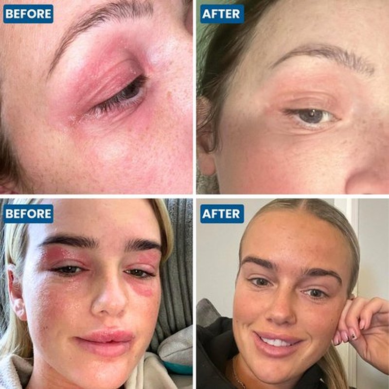 Grahams Natural Face & Eyelid Oil - For Very Dry Skin Around Eye & Face, Eczema & Perioral Dermatitis - Steroid-Free, Hypoallergenic, Non-Comedogenic - 100% Pure - with Argan & Jojoba Oil (1.69 Fl Oz)