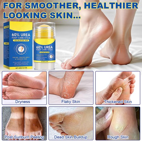 Eqimznv 60% Urea Cream Stick with 2% Salicylic Acid, Maximum Strength Urea Foot Cream Moisturizer, for Dry Cracked Heels, Knees, Elbows, Hands, Hydrates Dry Skin & Gently Exfoliates Dead Skin (2PCS)