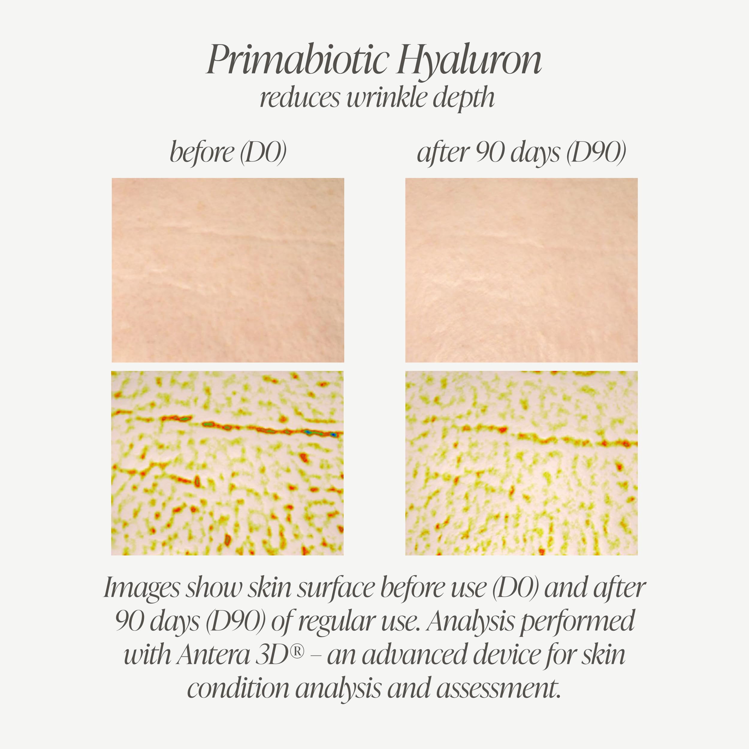 PRIMABIOTIC Hyaluronic Acid 250mg - Mango Flavor - Vegan, Deep Hydration, Anti-Aging and Skin Elasticity Support - Beauty Drink - Pack of 30 x 1 fl oz (30 mL) Bottles