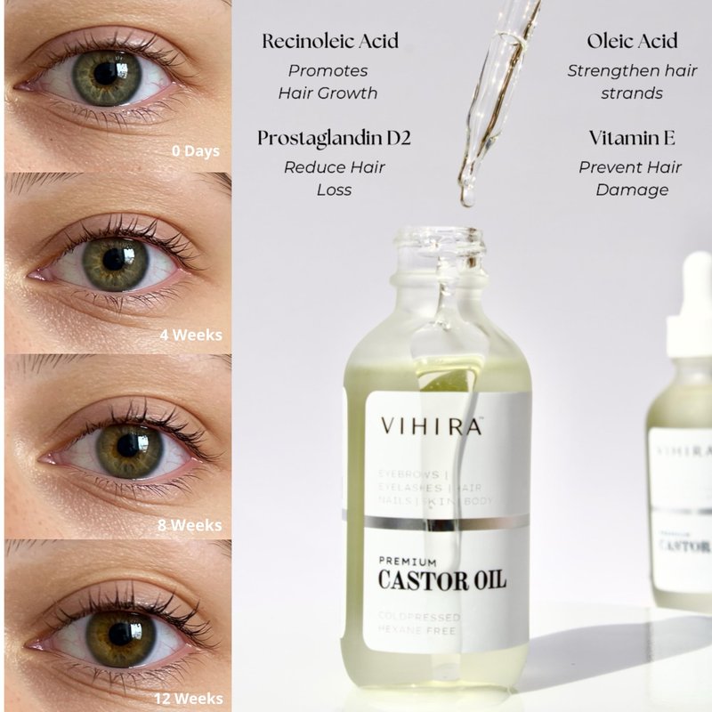 Vihira Organic Golden Castor Oil (2 Fl Oz | Premium Grade), True Cold Pressed, 100% Pure, Hexane Free, for Hair, Eyelash, Eyebrow, Cuticles, Nails, Skin, Belly Button & More.