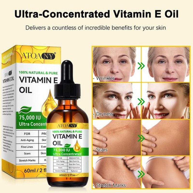 flasture Vitamin E Oil 75,000 IU – 100% Pure Natural Vitamin E for Skin, Face, Hair, Scars – Deep Moisturizing Body Oil for Dry Skin, Wrinkles – Cold-Pressed, Non-GMO,Skincare – 2 Fl Oz