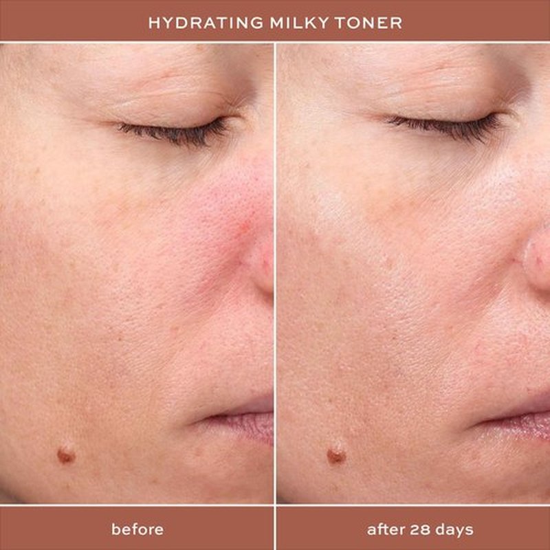 ITK Hydrating Hyaluronic Acid Milky Face Toner for Dry Skin + Redness with Green Tea + Squalane - Prep, Tone + Calm Skin for Women - Soothing Vegan Moisturizing Facial Toner - 5 oz.