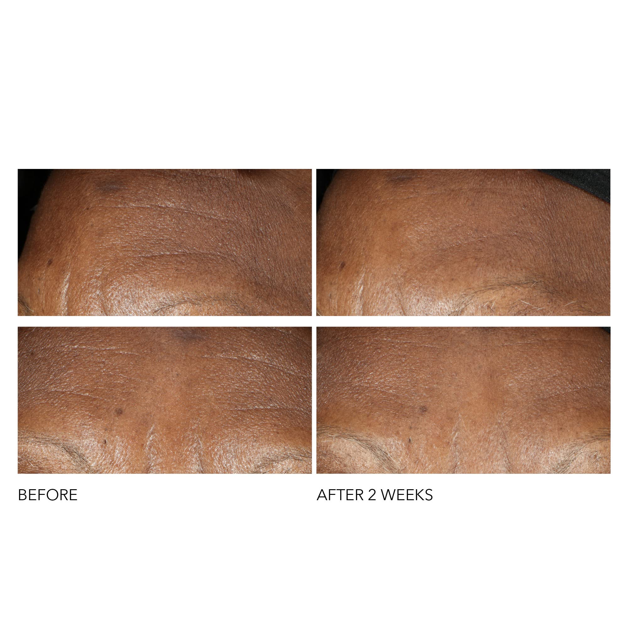 Dr Dennis Gross Advanced Retinol and Ferulic Intense Wrinkle Cream, White, 2 Ounce (Pack of 1)