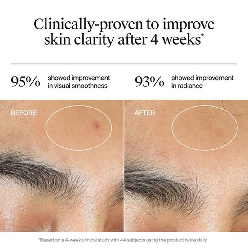 Neutrogena Evenly Clear Acne Gel Moisturizer with Salicylic Acid & N-Acetyl Glucosamine, Lightweight Non-Greasy Face Moisturizer Helps Treat Breakouts & Visibly Fade the look of Post-Acne, 1.7 fl. oz