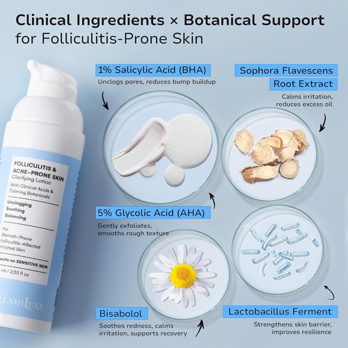 BellamiLuxx Folliculitis Acne Lotion - Soothes Itch & Redness, Reduces Body Acne & Bumps | Gentle Formula with Salicylic & Glycolic Acid