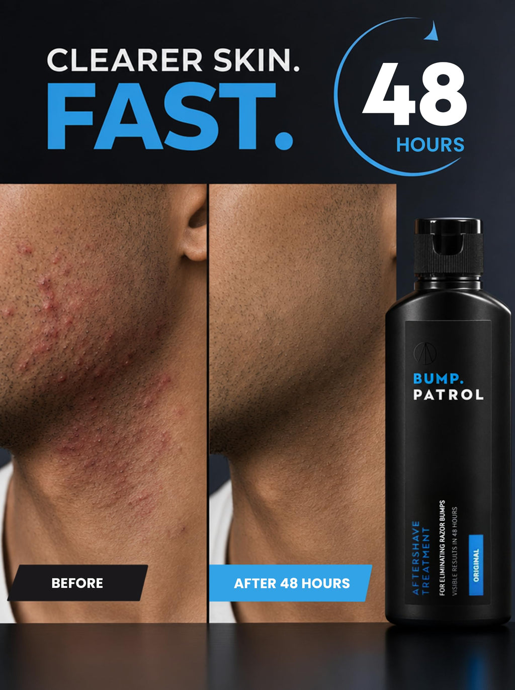 Bump Patrol Original Formula Aftershave Treatment Serum – Razor Bump Stopper and Ingrown Hair Treatment for Men and Women with Salicylic Acid for Razor Burn & Shaving Irritation - 2 oz - Pack of 2