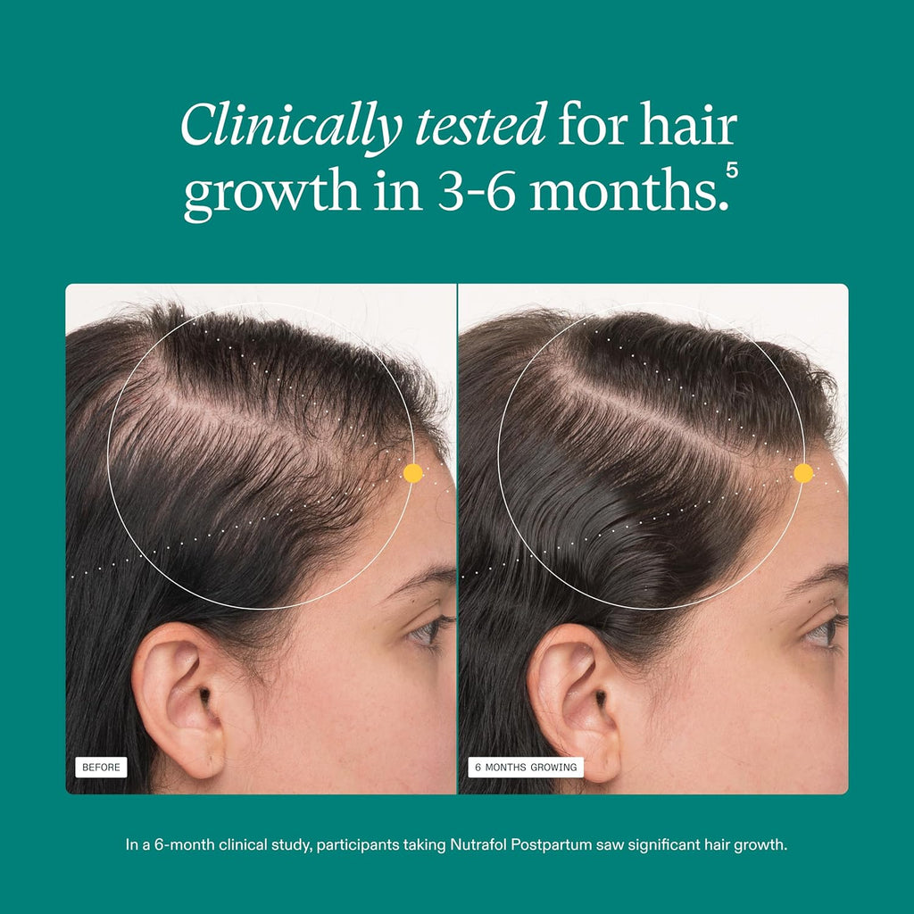 Nutrafol Postpartum Hair Growth Supplements - Clinically Tested for Thicker Hair | 2-Month Supply (Pack of 2)