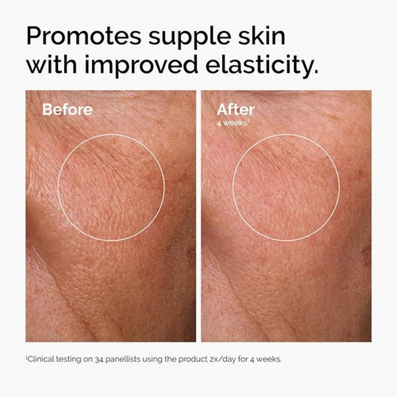 The Ordinary Serum Favorites Set - Hydrating Hyaluronic Acid 2% + Niacinamide 10% + Caffeine Solution | Eye & Face Care