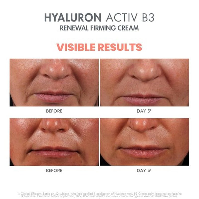 Avène Hyaluron Activ B3 Firming Cream - Renew Skin's Youthful Glow | 1.69 oz