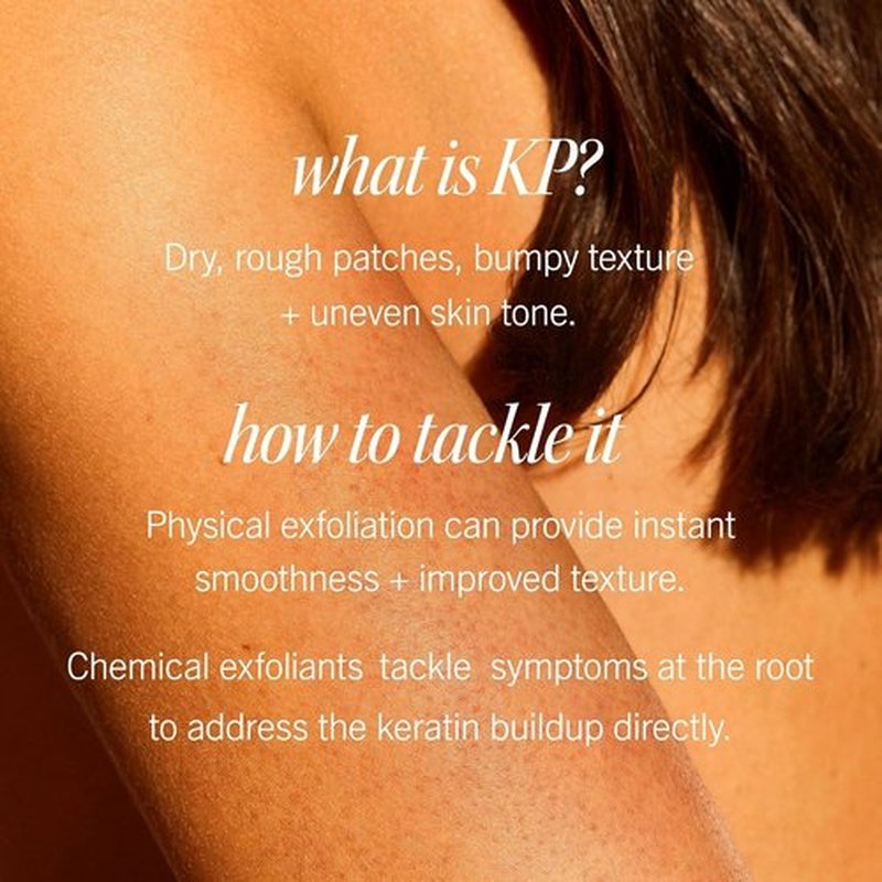 First Aid Beauty - KP Bump Eraser Body Scrub | 10% AHA Exfoliator for Keratosis Pilaris, Peach Scent (2 oz)