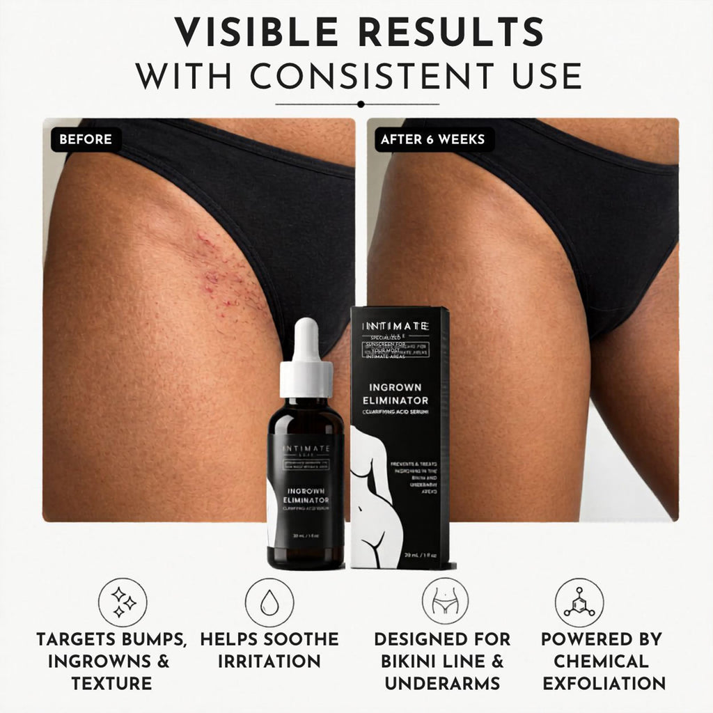 Intimate Luxe Ingrown Hair Treatment Serum – Razor Bump & Ingrown Eliminator for Bikini Line, Underarms & Body| Shave & Post Wax Care for Women & Men| Fragrance-Free with Lactic & Salicylic Acid –30ml