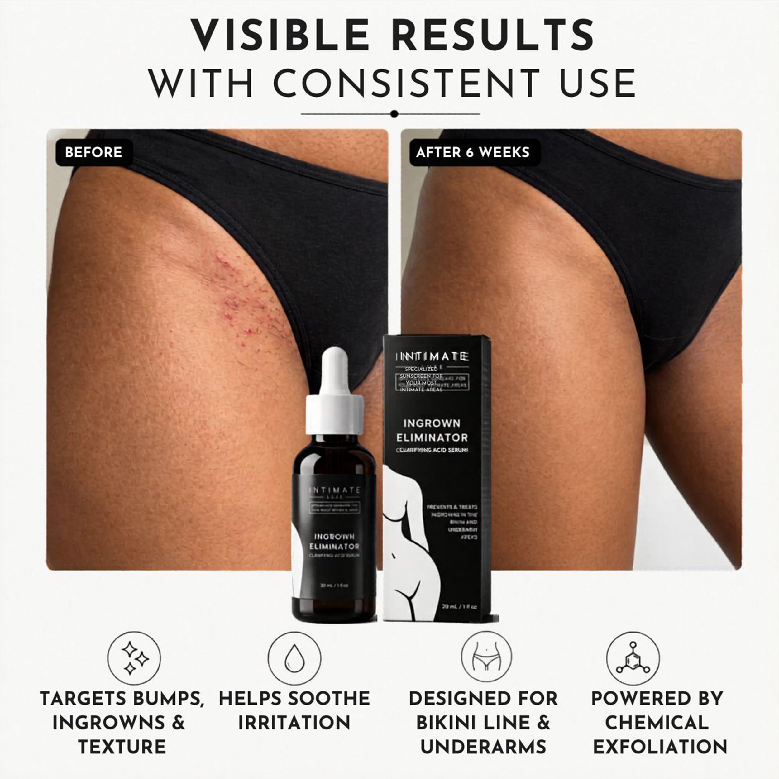 Intimate Luxe Ingrown Hair Treatment Serum – Razor Bump & Ingrown Eliminator for Bikini Line, Underarms & Body| Shave & Post Wax Care for Women & Men| Fragrance-Free with Lactic & Salicylic Acid –30ml