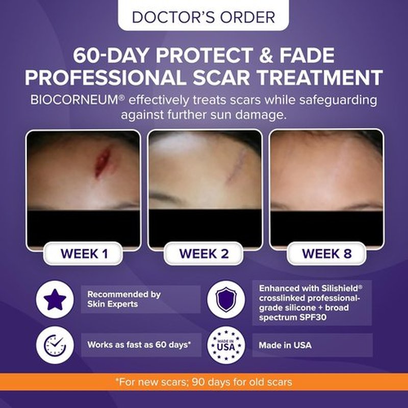 Silishield® Advanced Scar Treatment Gel - Silicone Formula with SPF 30 for Surgical & Keloid Scars - 20g, Safe for All Ages, Made in USA