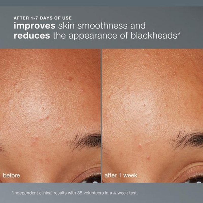 Dermalogica Daily Microfoliant - Exfoliating Face Scrub Powder with Salicylic Acid & Papaya Enzyme for Brighter, Smoother Skin