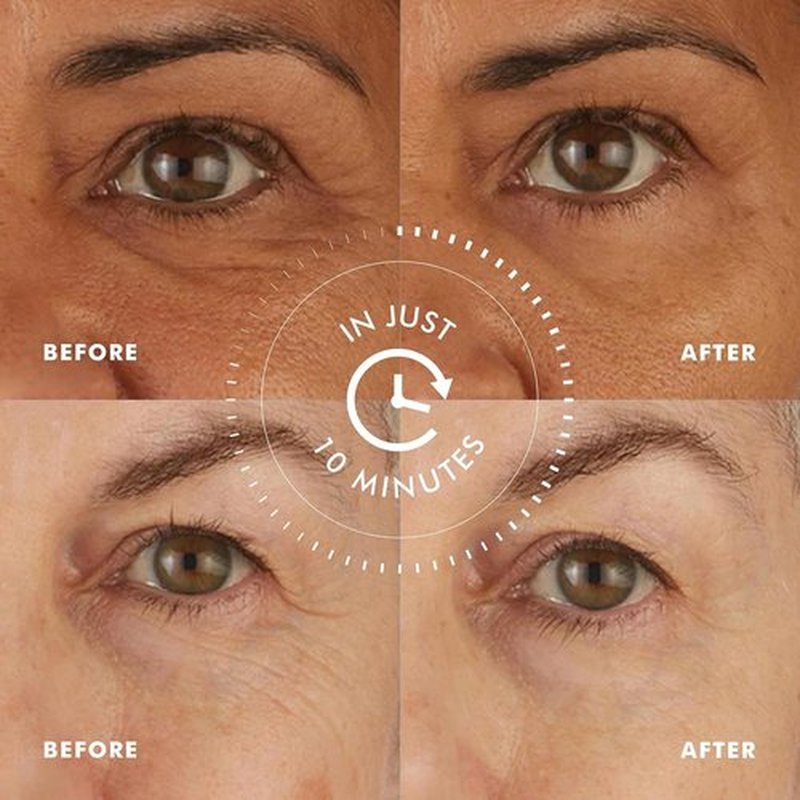 Skyn ICELAND Hydro Cool Firming Eye Gel Patches - Reduce Dark Circles & Puffiness | 4 Pairs
