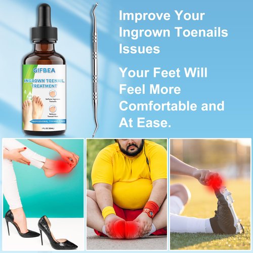Ingrown Toenail Treatment w/Ingrown Toenail Drops Reliever & Softener,Double Sided Pedicure Nail Lifter Tool for Easy Trimming Care Thick Nail & Ingrown Toe Nail,Toenail Cleaner Kit for Men Women