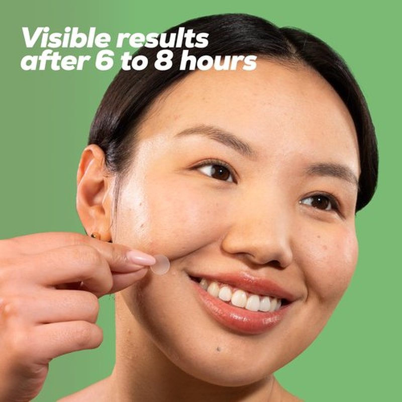 HANHOO Soothing Blemish Patch with Aloe, Madecassic Acid, and Tea Tree Extract | Hydrocolloid Spot Treatment | Calms Pre-stage, Irritated, and Popped Blemishes 216 count