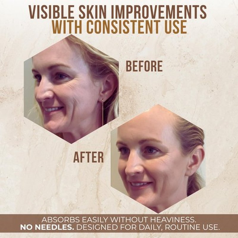 Bee Venom Skin Treatment Cream | Face & Neck Wrinkle Moisturizer That Firms & Tightens | Made In USA | Hydrating Skin Restoration with Smoothing Effect | Instant Face Lift Cream, 4oz