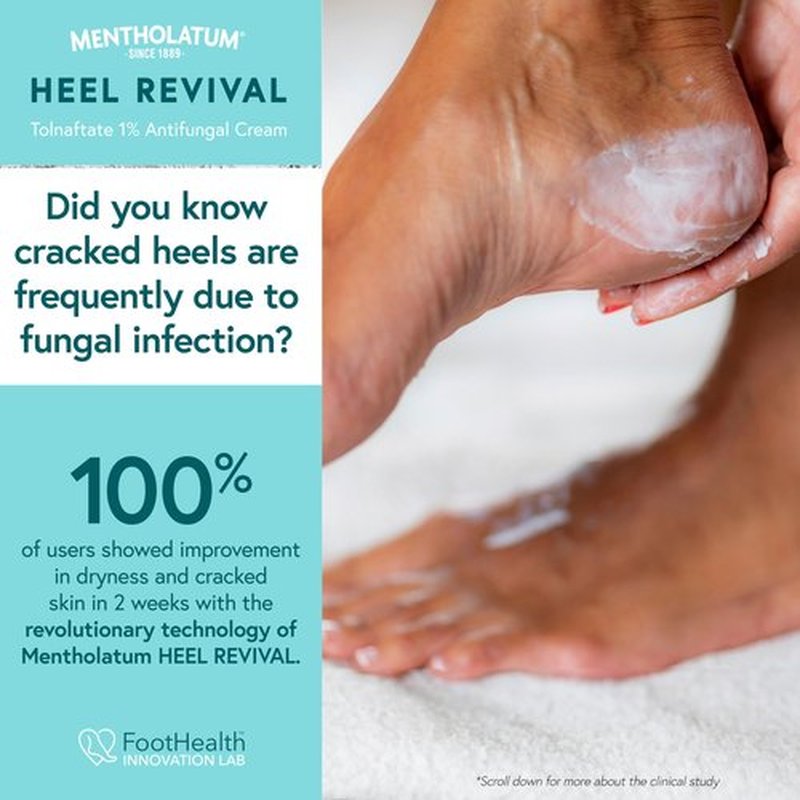 Mentholatum Heel Revival, Persistent Cracked Heel Repair Treatment, 1% Tolnaftate Antifungal Cream, Antifungal Foot Treatment, Eliminates & Prevents Fungus, 1 OZ
