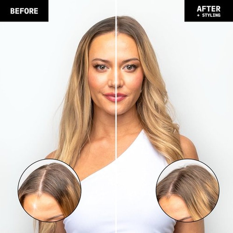 FoxyBae Overnight Dry Shampoo Spray - Biotin & Charcoal Formula for Oil Control | 7 fl oz