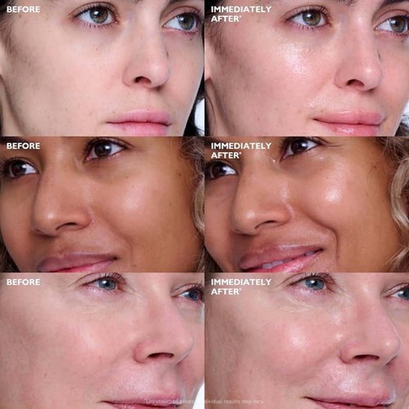 Peter Thomas Roth | Collagen Skinjection™ Plumping & Firming Serum | Exosome Face Serum with Collagen Peptides