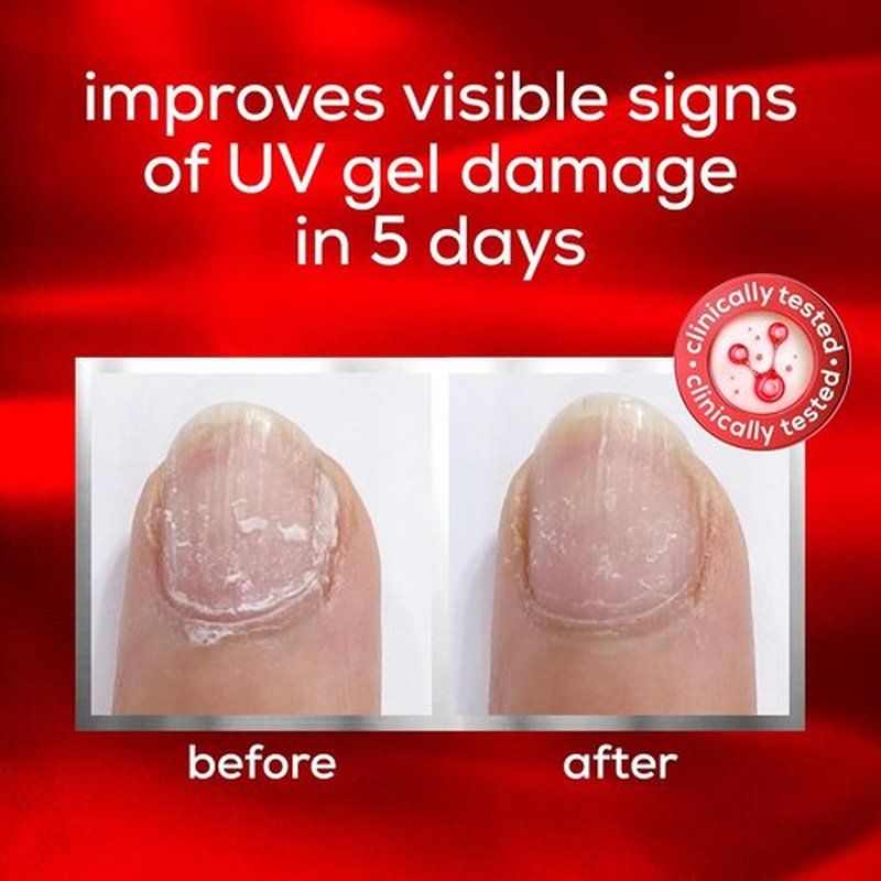 Essie Nail Care | UV Gel Damage Repair Treatment - To The Rescue Base Coat, 0.46 Fl Oz