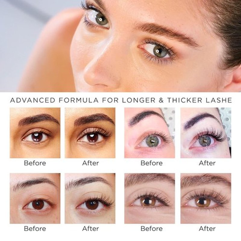 Skiennix Natural Vine Eyelash Growth Serum - Vegan Formula for Longer, Fuller Lashes | 3mL Supply