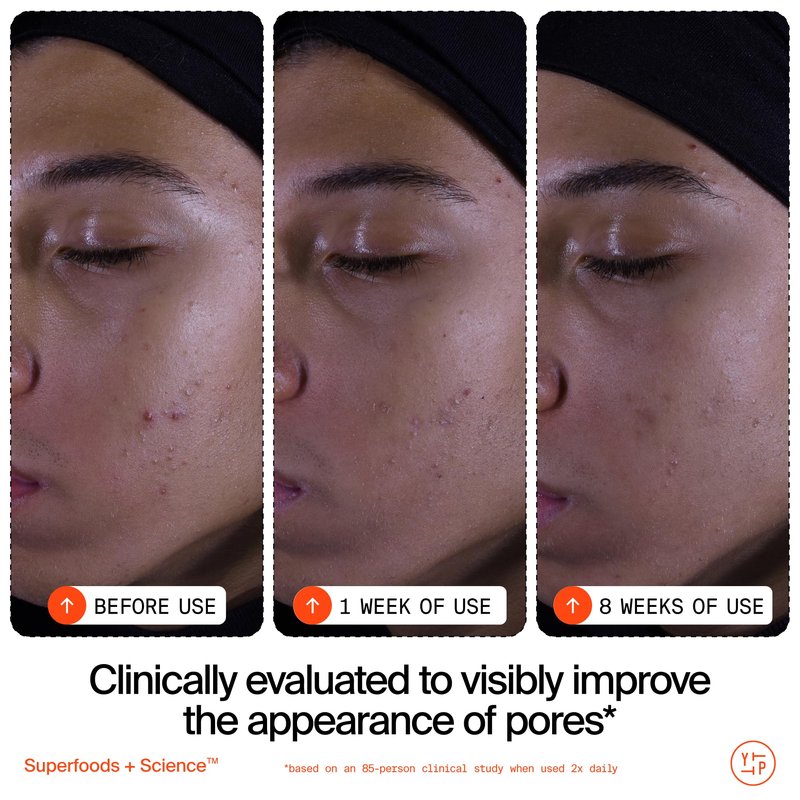 Youth To The People Superfruit Facial Cleanser Full Size - Papaya + Vitamin C Exfoliating Face Wash, Skin Renewal with AHA + BHA, Evens Tone & Texture for Soft + Radiant Skin - 5 fl oz
