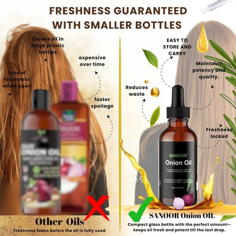 SANOOR Himalayan Red Onions Oil | 100% Pure (2.02oz)| Cold-pressed, stimulates hair growth, strengthens follicles, and treats infections for healthier hair | 60ml