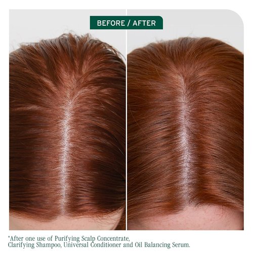 Biolage Scalp Sync Clarifying Shampoo - Remove Residue & Buildup for Oily Scalps