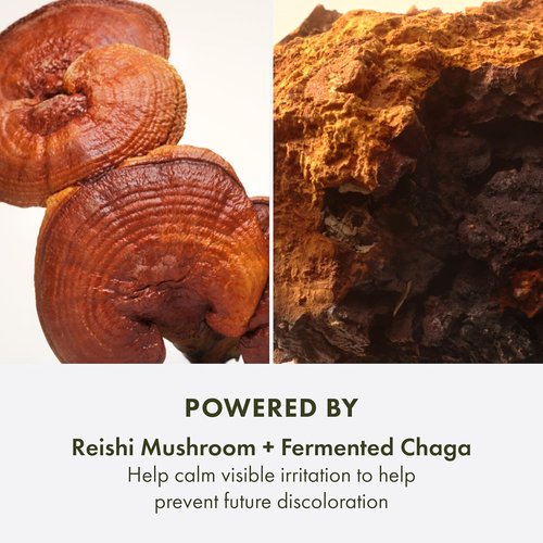 Origins Mega-Mushroom Dark Spot Serum - Reduces Hyperpigmentation & Acne Marks | Enriched with Vitamin C & Reishi, 1 Fl Oz