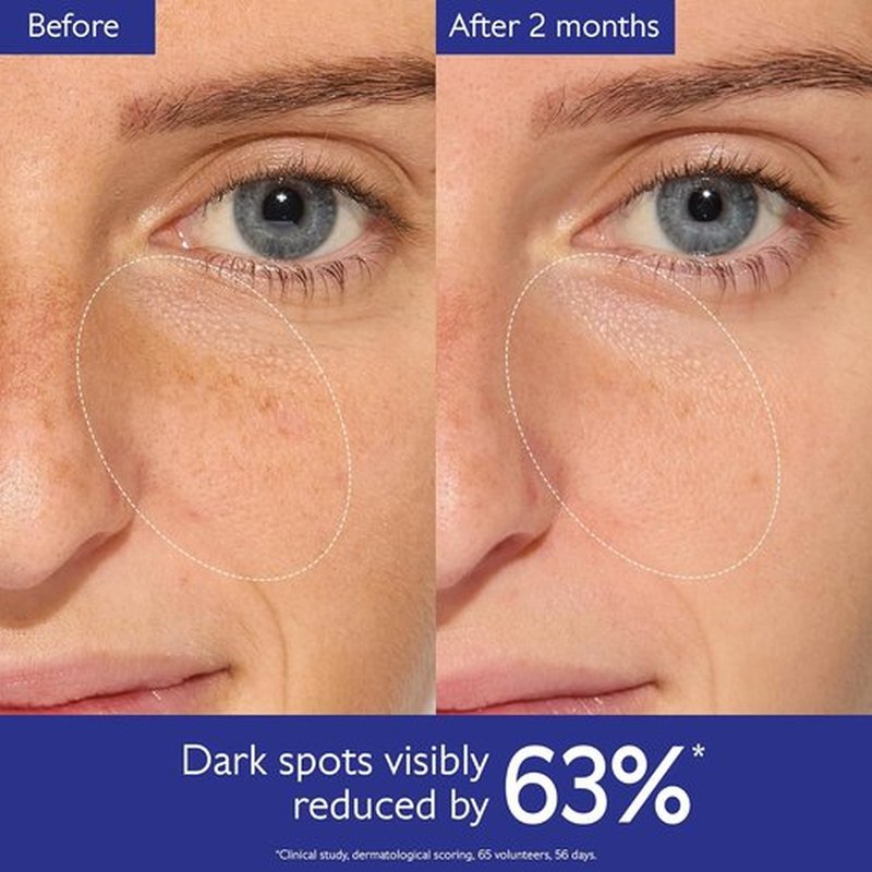Caudalie Vinoperfect Brightening Dark Spot Serum - 62X More Effective Than Vitamin C for Even Skin Tone