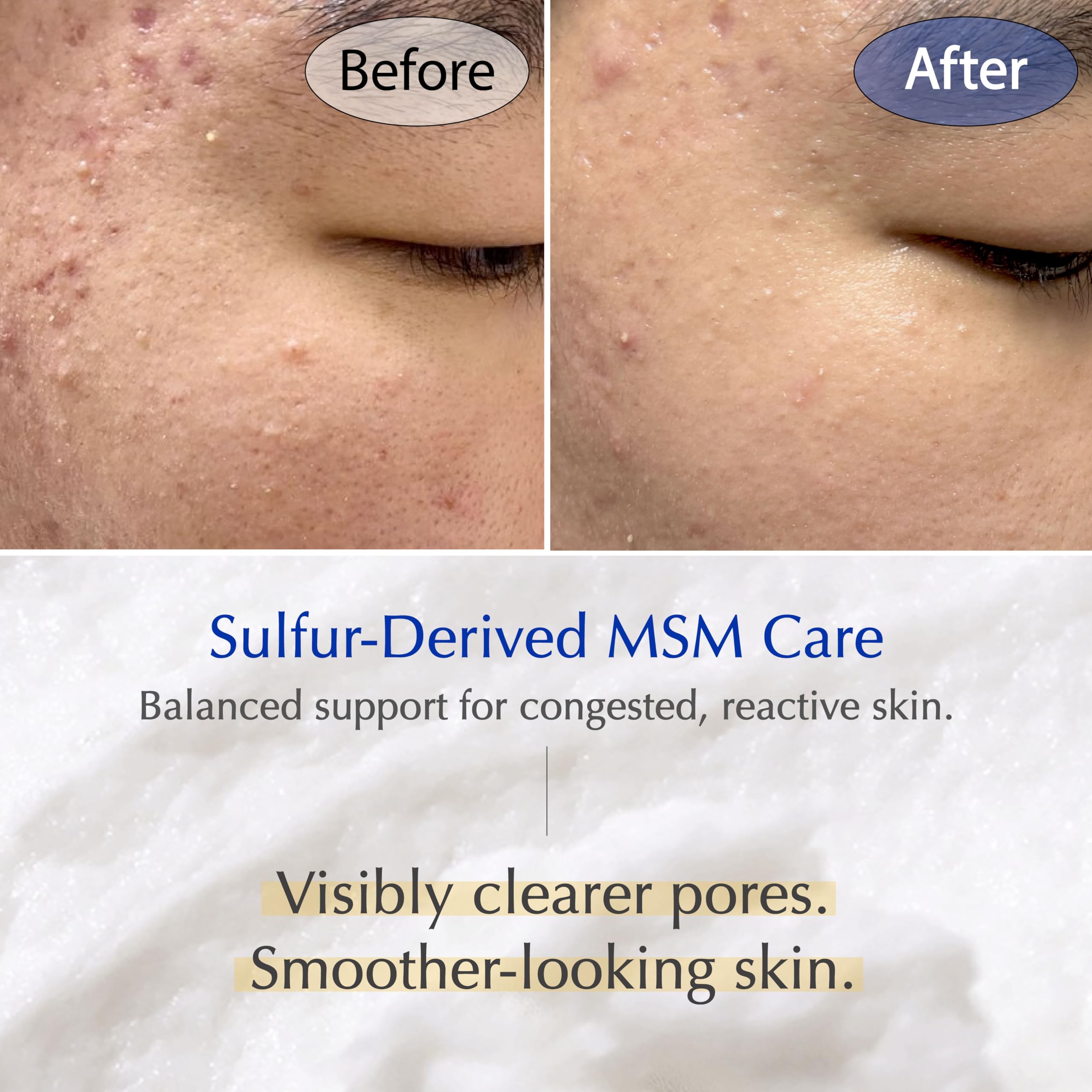 liv.reome MSM Sulfur Deep Pore Cleanser – Low pH Barrier-Respecting Face Wash, Pore Reset for Sensitive Skin