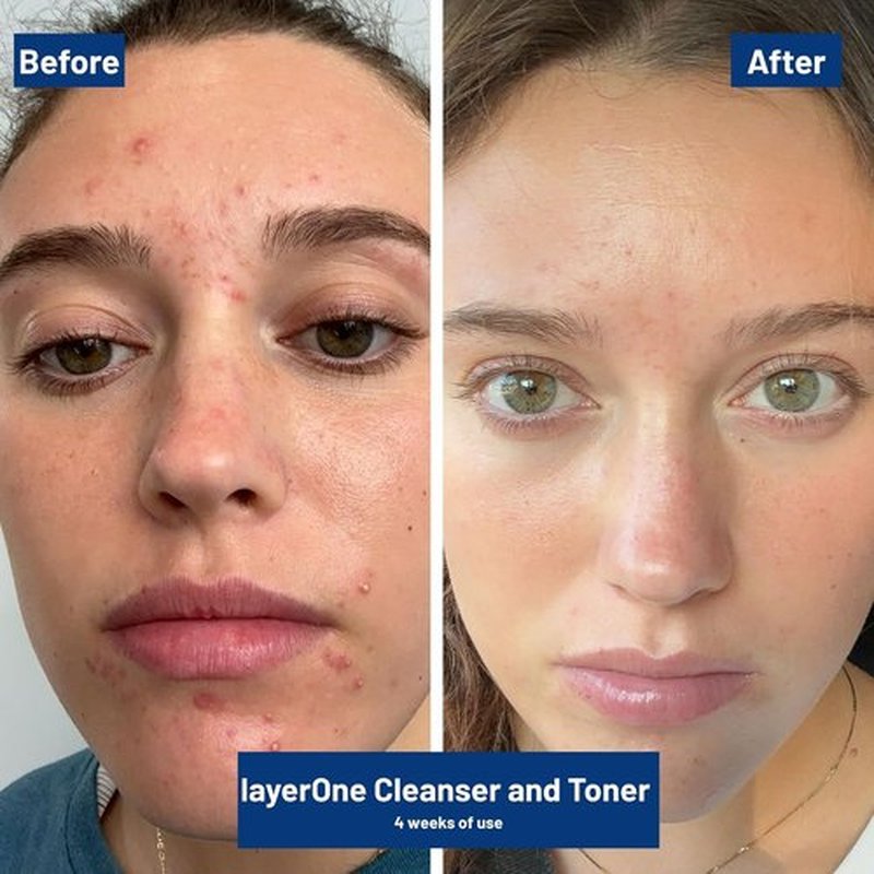 layerOne Clarifying Enzyme Toner - Soothes, Hydrates & Refines Skin for Perfect Skincare Prep | 3.38 fl oz
