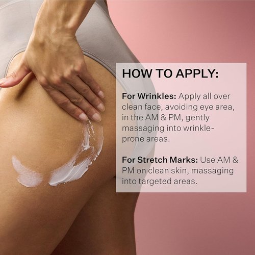 StriVectin SD Advanced Plus Moisturizer - Anti-Wrinkle & Stretch Mark Formula | Collagen-Boosting Peptides & Hyaluronic Acid