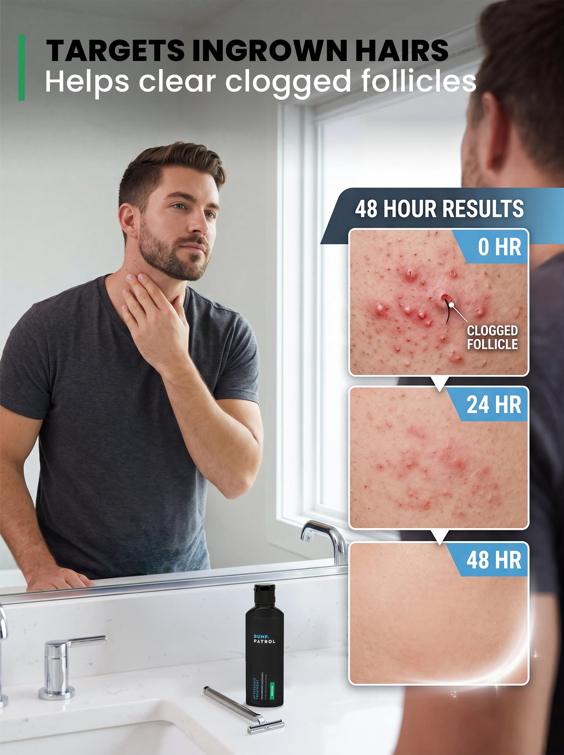 Bump Patrol Sensitive Strength Aftershave Treatment Serum – Razor Bump Stopper and Ingrown Hair Treatment for Men and Women, Alcohol Free Ingrown Hair Serum for Sensitive Skin