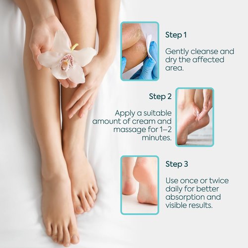 Clasy Care Foot Moisturizing Cream – Hydrating Heel & Foot Cream with Vitamin E and Avocado Oil – Softens Dry, Rough Skin – Nourishing Daily Foot Care, 100 ml