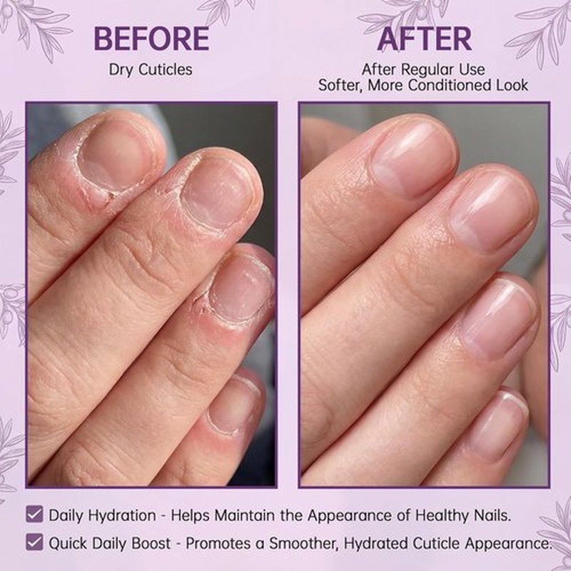 Skiennix Cuticle Oil Pen - Hydrating Nail Moisturizer with Jojoba Oil & Vitamin E | 15ml Portable Brush Pen