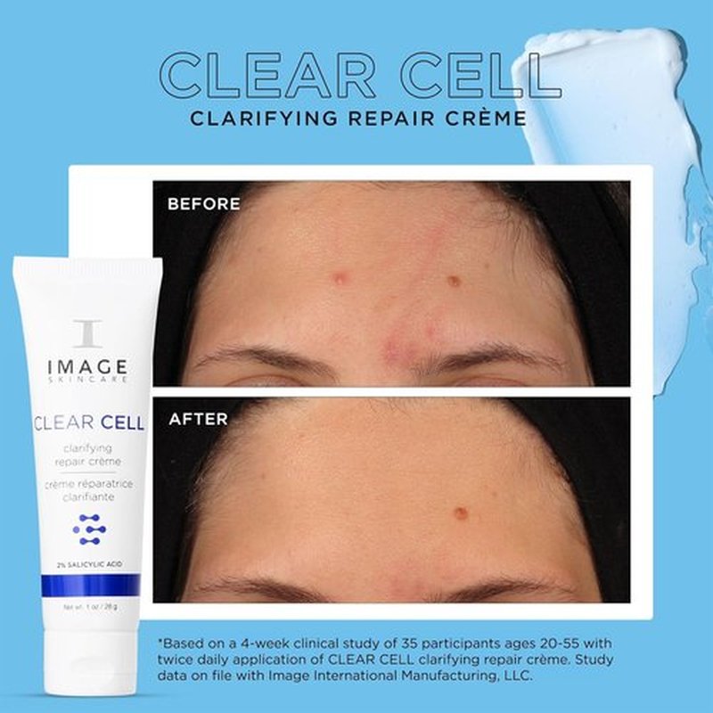 IMAGE Skincare | CLEAR CELL Clarifying Repair Crème - Night Gel Moisturizer for Oily Skin