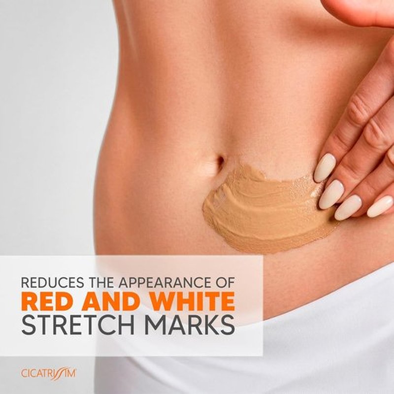 Cicatrissim Stretch Mark Cream - Softens & Firms Skin, Evens Tone - For All Skin Types - 150g