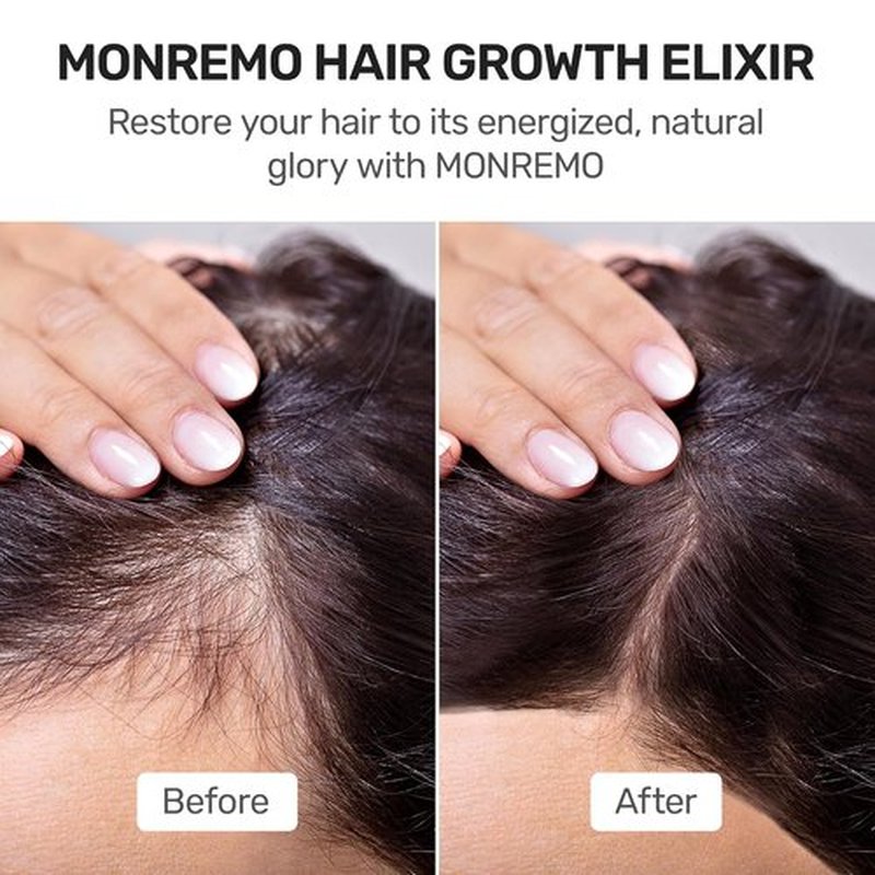 Skiennix Hair Growth Serum - Fast-Absorbing Turmeric & Biotin Treatment for Thinning Hair | Lightweight Vegan Formula for Men & Women