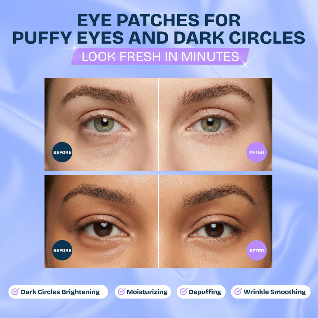 MAREE Under Eye Patches for Puffy Eyes and Dark Circles – Under Eye Mask with Collagen & Hyaluronic Acid – Undereye Mask Patches for Women – Parches para Ojeras Puffiness & Under Eye Bags | 12 Pair