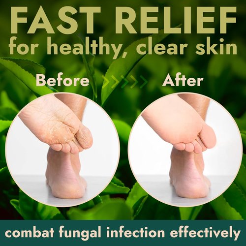 Foot Scrub with Tea Tree Oil | Callus Remover For Feet | Exfoliating Scrub with Salicylic and Glycolic Acid for Dead Skin, Athlete’s Foot, Warts, Corns, Rashes, Foot Odor, Insect Bites and Foot Care