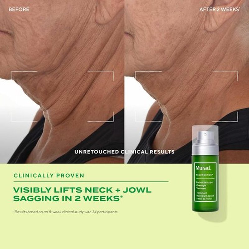 Murad Retinal ReSculpt Overnight Treatment - Advanced Face & Neck Serum for Deep Wrinkles & Lift