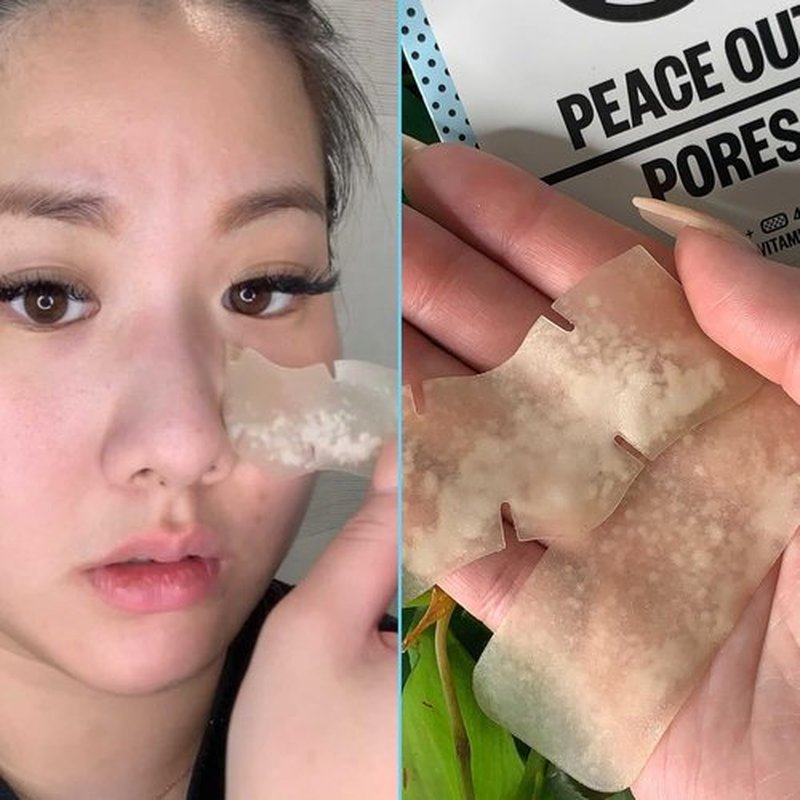Peace Out Pore Strips - Oil Absorbing Hydrocolloid Blackhead Remover for Nose & Face | 8 Count