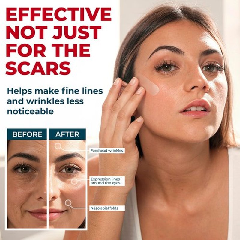 Medical Grade Silicone Scar Tape - 1.6”x150” - Visible Difference on Keloid & С-Section - Reusable Silicone Scar Sheets - Easy to Use