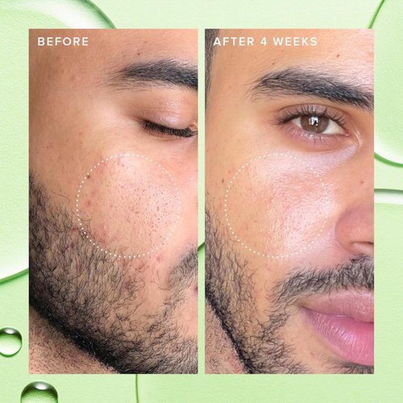 Farmacy 2% Salicylic Acid Toner - Deep Sweep BHA Exfoliant & Pore Cleaner for Oily Skin (120ml)